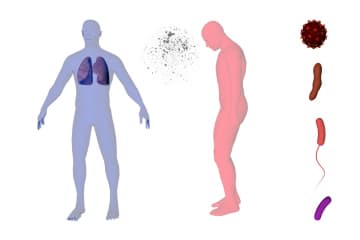 Infectious diseases