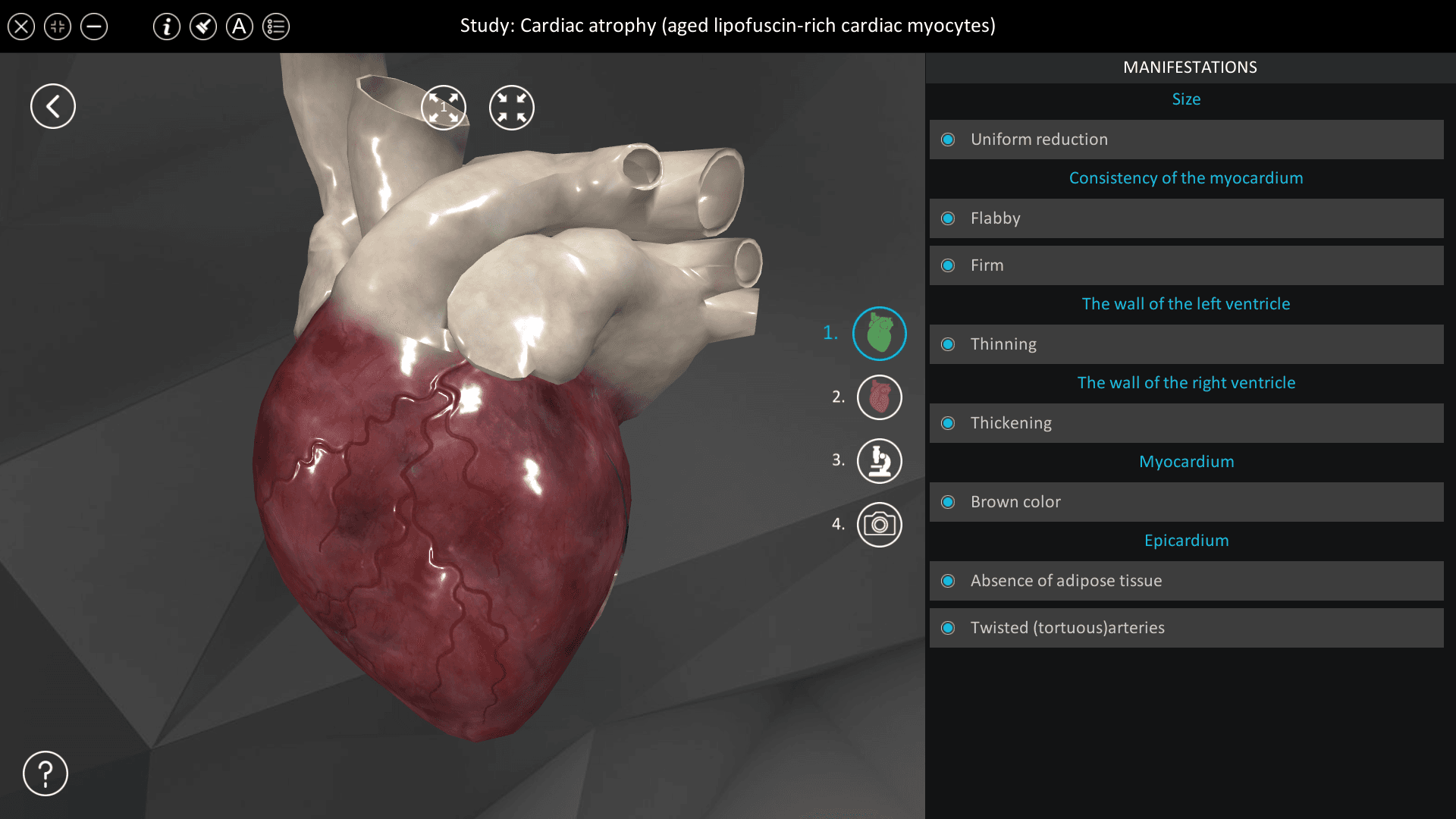 Cardiac atrophy (aged lipofuscin-rich cardiac myocytes)