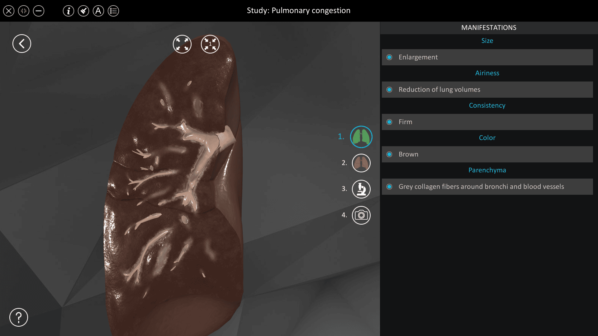 Pulmonary congestion
