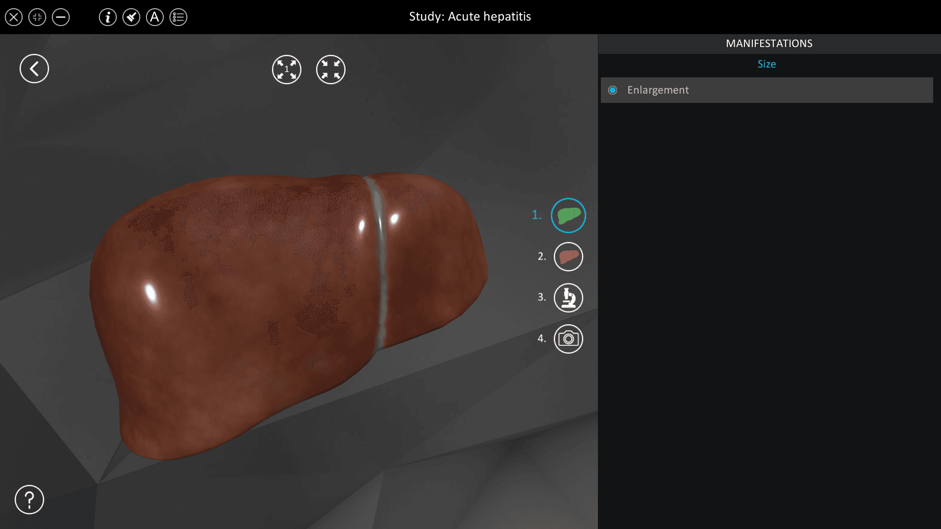 Acute hepatitis