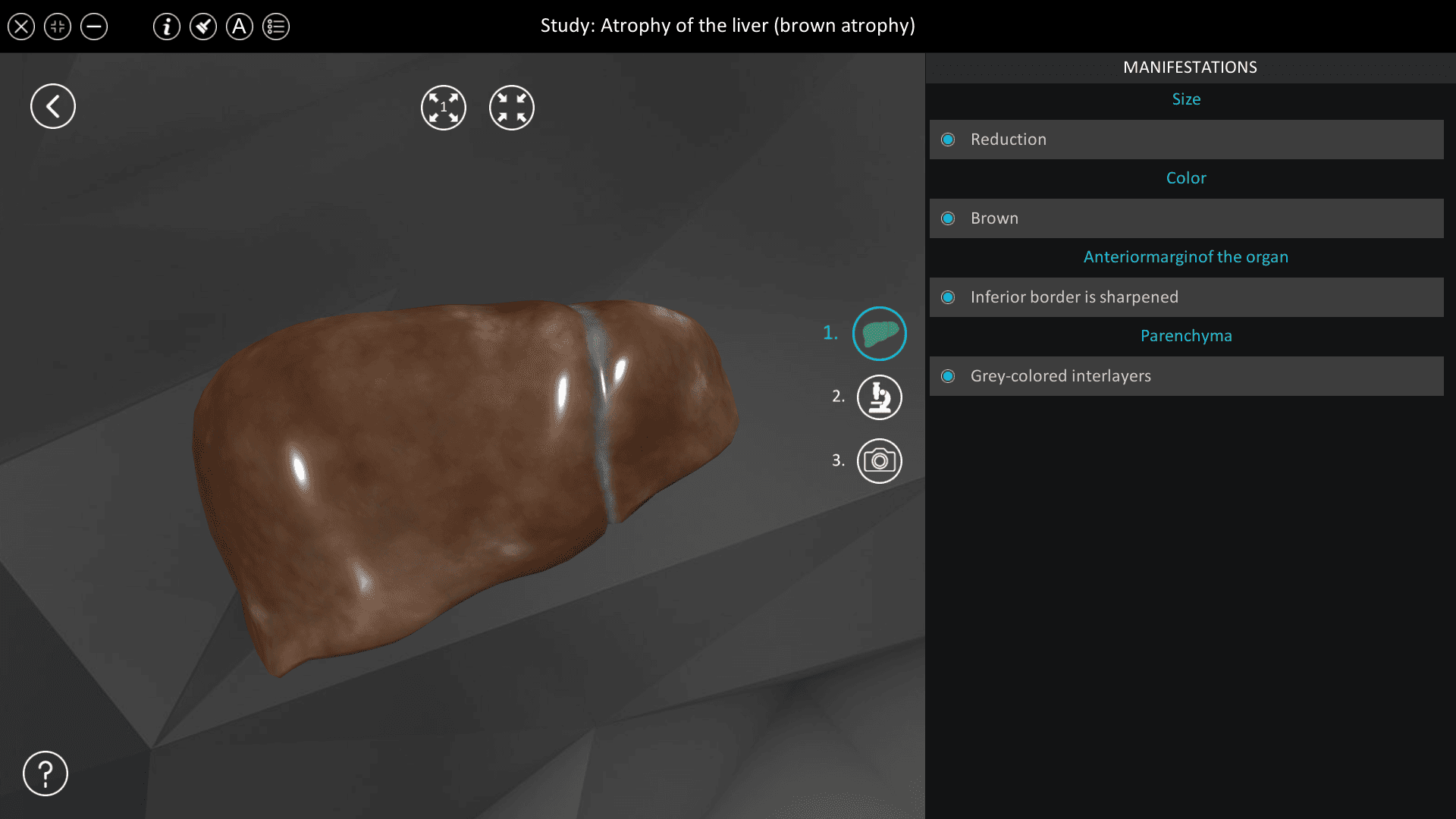 Atrophy of the liver (brown atrophy)