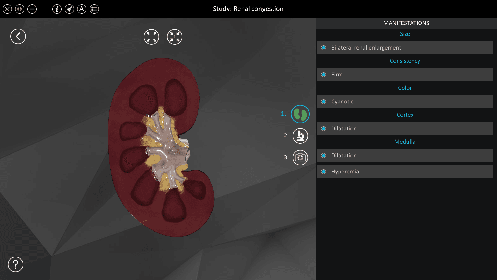 Renal congestion