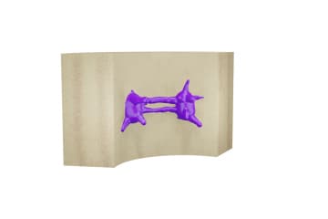 Osteon