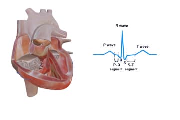 Electrocardiogram and heartbeat